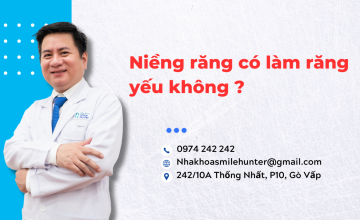 Niềng răng có làm răng yếu không ?