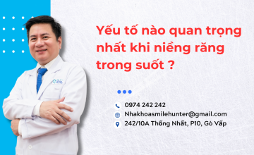 Yếu tố nào quan trọng nhất khi niềng răng trong suốt ?