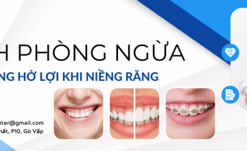 CÁCH PHÒNG NGỪA TÌNH TRẠNG HỞ LỢI KHI NIỀNG RĂNG