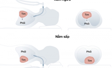 Bác sĩ hướng dẫn F0 ở nhà tập thở phục hồi phổi