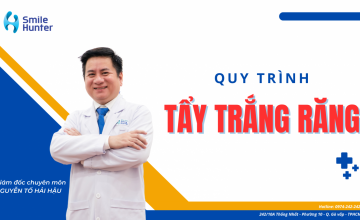 QUY TRÌNH TẨY TRẮNG RĂNG GỒM NHỮNG BƯỚC NÀO