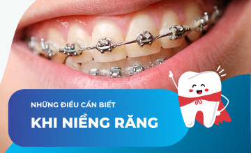 NHỮNG ĐIỀU CẦN BIẾT TRƯỚC KHI NIỀNG RĂNG