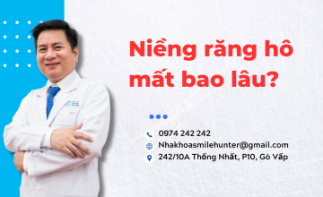 Niềng răng hô mất bao lâu ?