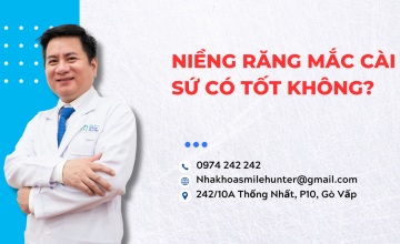 Niềng răng mắc cài sứ có tốt không?