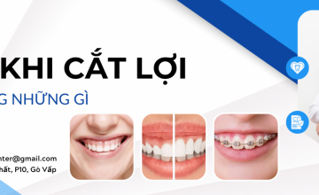 SAU KHI CẮT LỢI NÊN KIÊNG CỬ NHỮNG GÌ?