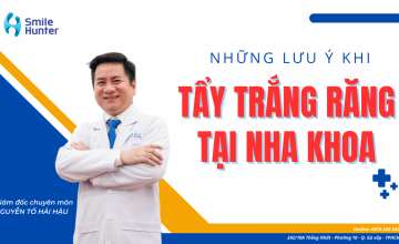 NHỮNG LƯU Ý KHI TẨY TRẮNG RĂNG TẠI NHA KHOA