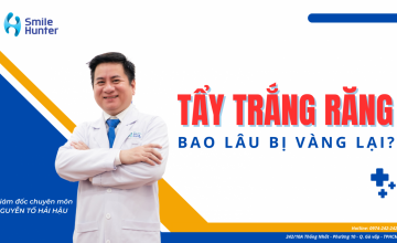 TẨY TRẮNG RĂNG GIỮ ĐƯỢC BAO LÂU? KHI NÀO BỊ Ố VÀNG TRỞ LẠI?