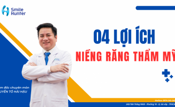 CÁC LỢI ÍCH KHI NIỀNG RĂNG THẨM MỸ