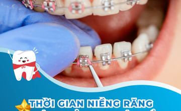 THỜI GIAN NIỀNG RĂNG HIỆU QUẢ THEO ĐỘ TUỔI