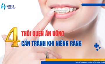 4 THÓI QUEN ĂN UỐNG NÊN TRÁNH KHI NIỀNG RĂNG