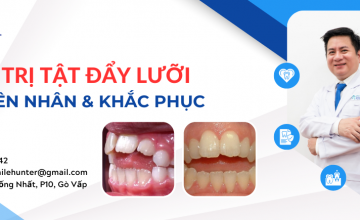 ĐIỀU TRỊ TẬT ĐẨY LƯỠI: NGUYÊN NHÂN & CÁC KHẮC PHỤC