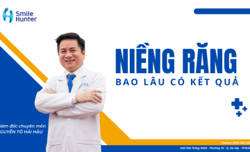 NIỀNG RĂNG BAO LÂU THÌ CÓ KẾT QUẢ