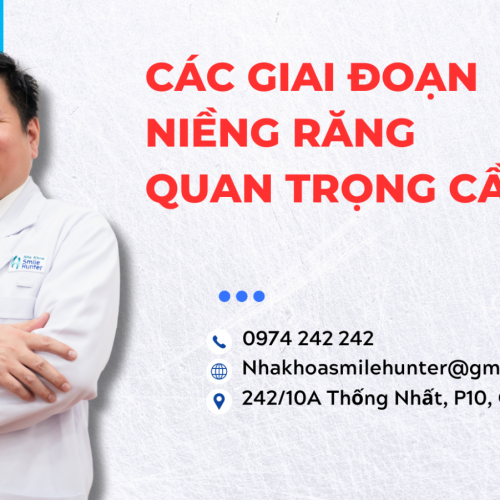 CÁC GIAI ĐOẠN NIỀNG RĂNG QUAN TRỌNG CẦN LƯU Ý