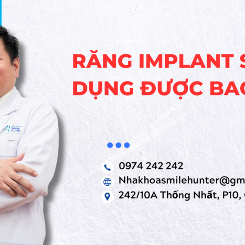 TRỒNG RĂNG IMPLANT SỬ DỤNG ĐƯỢC BAO LÂU?