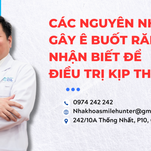 CÁC NGUYÊN NHÂN GÂY Ê BUỐT RĂNG