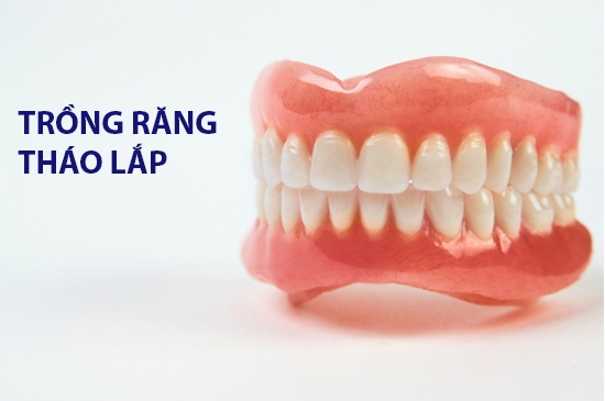 Trồng Răng Tháo Lắp